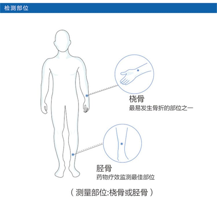 osteokj7000骨密度仪检测部位