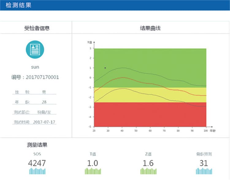 osteokj7000骨密度仪检测报告