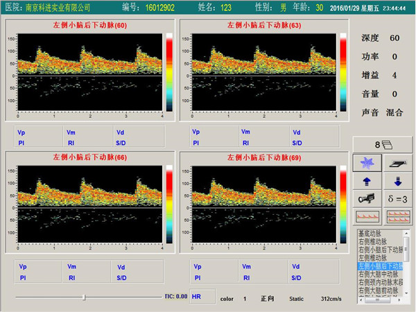 经颅多普勒单通道，四深度界面