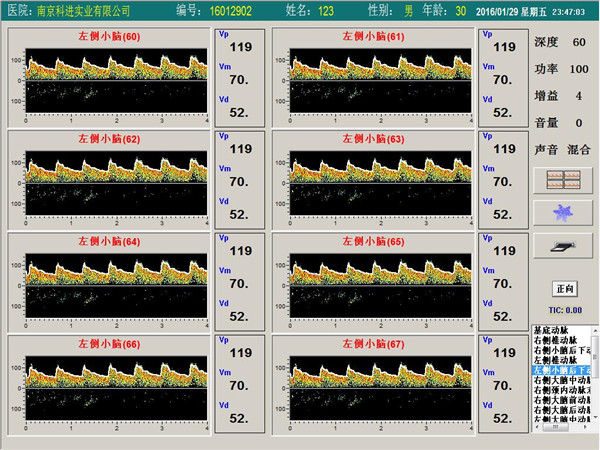 经颅多普勒单通道，八深度界面