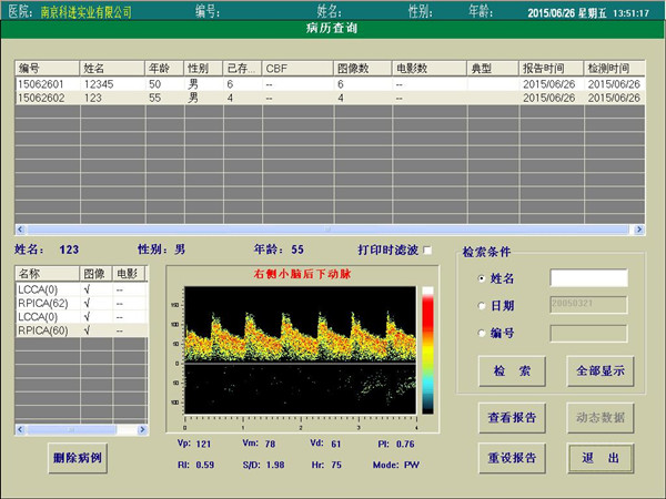 经颅多普勒报告查询界面.jpg