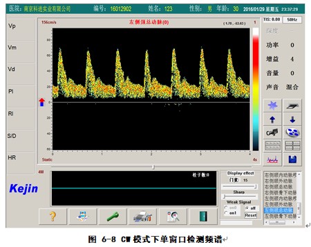 经颅多普勒软件cw模式下检测界面.JPG