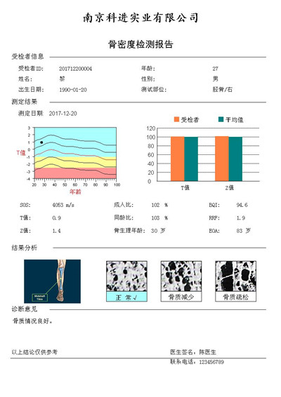 KJ7000+胫骨报告单.jpg