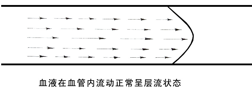 血液在血管内流动正常呈层流状态.jpg