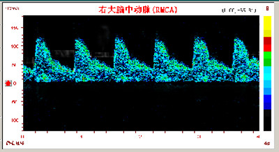 频谱异常的情况.jpg