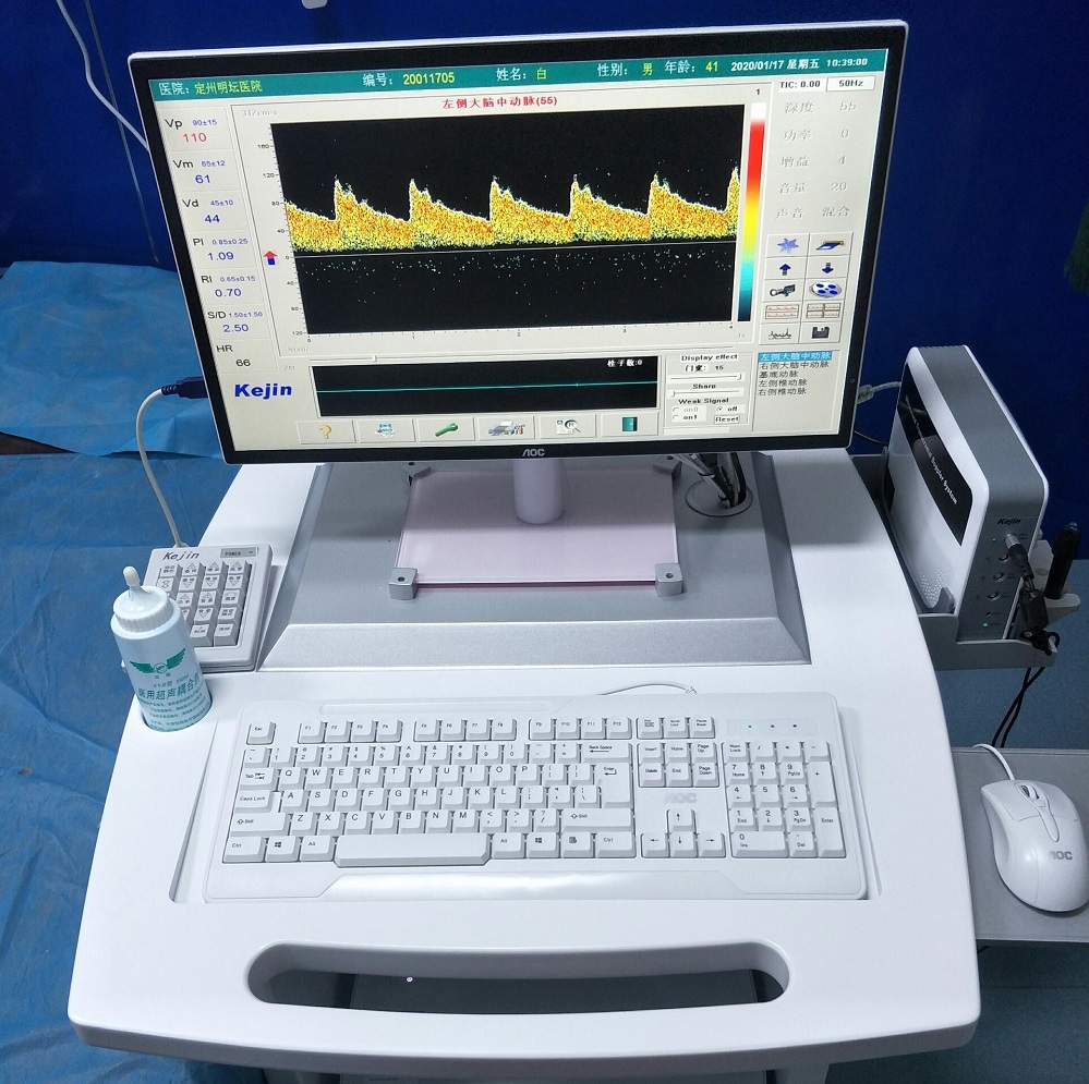澳思泰经颅多普勒仪安装案例