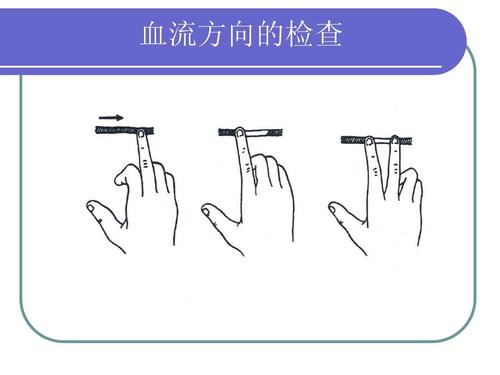 超声经颅多普勒对颅内血流方向的检查