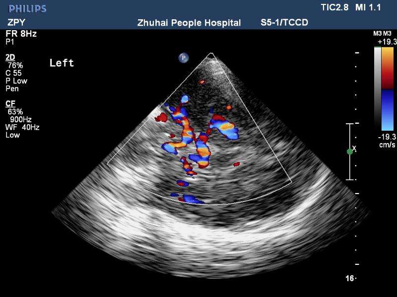 TCCD成像图片