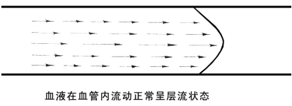 TCD厂家带你了解TCD频谱图形的名词