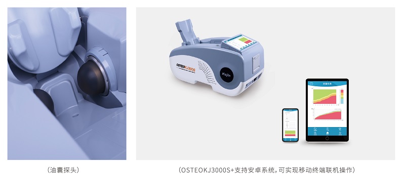 OSTEOKJ3000S/S+超声骨密度仪