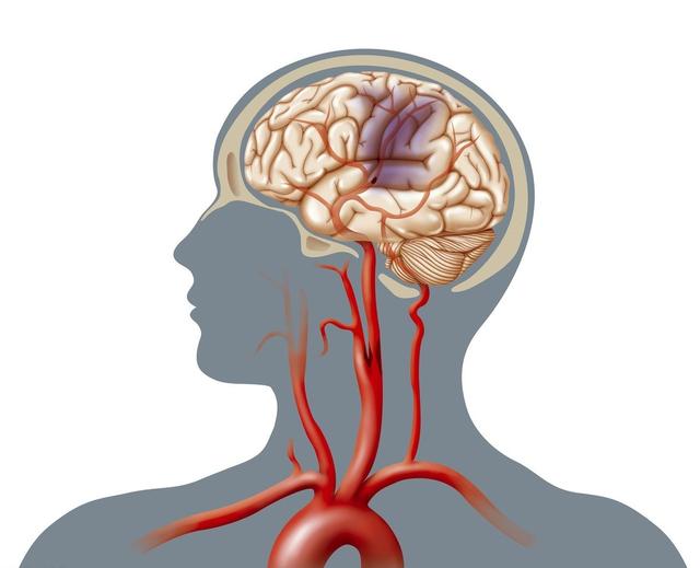 因病致死一半是由心脑血管疾病引起的