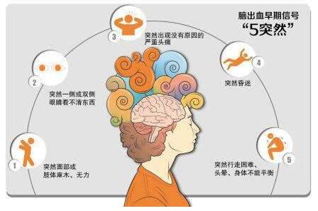 心脑血管病别等发作才筛查，经颅多普勒TCD超声检测心脑血管